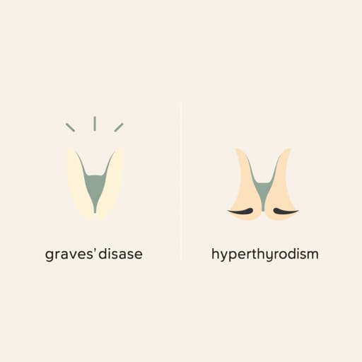 Graves Disease vs Hyperthyroidism