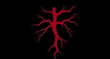 Corrected Transposition Of The Great Arteries