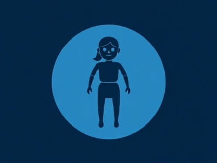 Jones Major Criteria For Rheumatic Fever