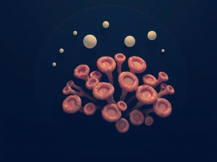 Porous Coral Like Outgrowths In The Orbits