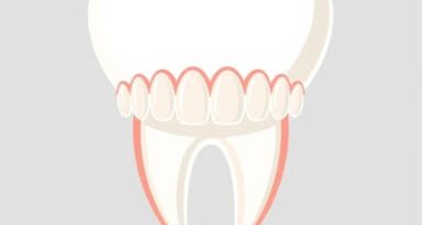 Premolar Classification Of Malocclusion