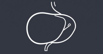 Right Hepatic Lobe Cyst