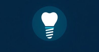 U Of M Dental Implant Cost