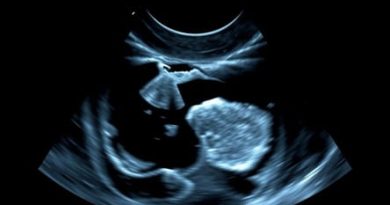 Ultrasound For Capsular Contracture Near Me