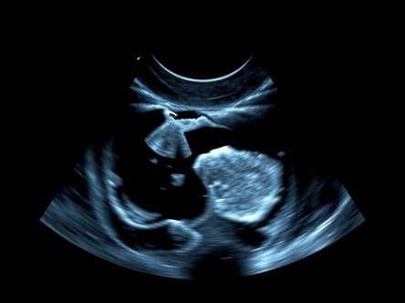 Ultrasound For Capsular Contracture Near Me