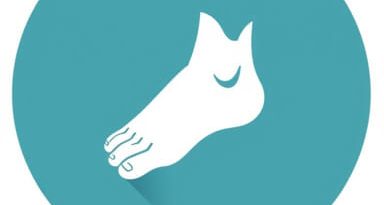 Untreated Clubfoot In Adults