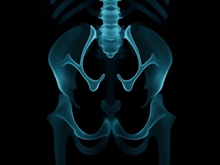 Urethral Injury X Ray