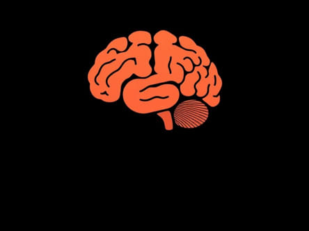 Vascular Dementia And Periods Of Lucidity