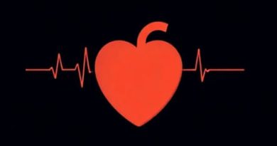 Ventricular Premature Complex Icd 10