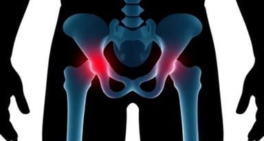 X Ray For Groin Injury