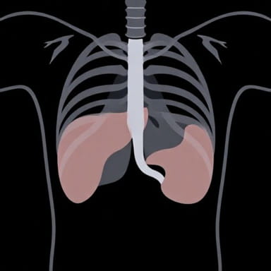 X Ray Of Pancreatic Cancer