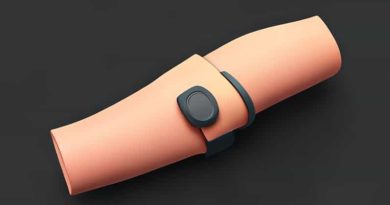 Extensor Compartment Of Wrist