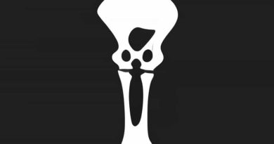 Greater Trochanter Of Femur