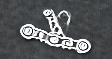 Adjustable Chain Gearshift Create