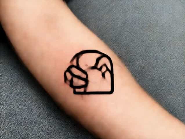 Bruise On Arm From Being Grabbed