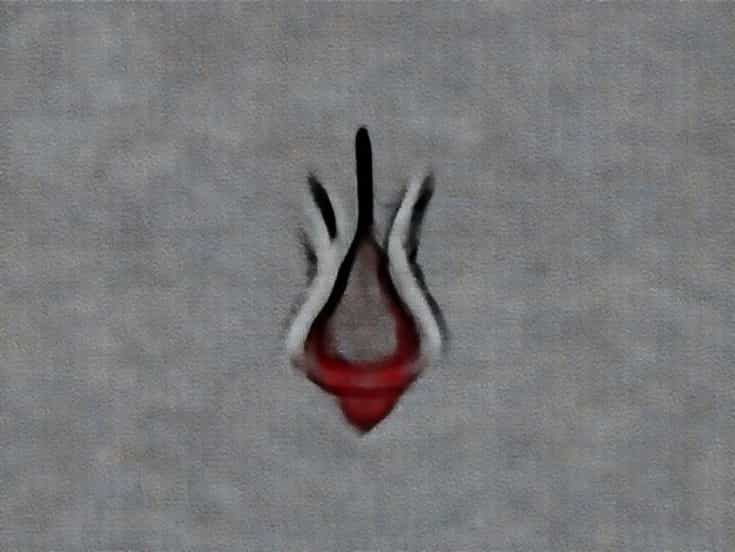 Hemorrhagic Septicemia Caused By