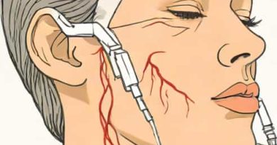 Jugular Vein Distention Treatment