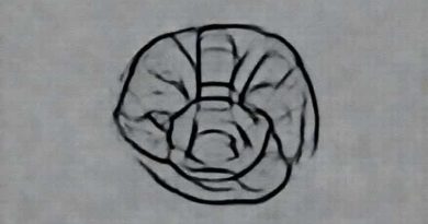 Low Grade Cartilaginous Neoplasm