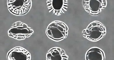 Reproduction In Protozoa Involves