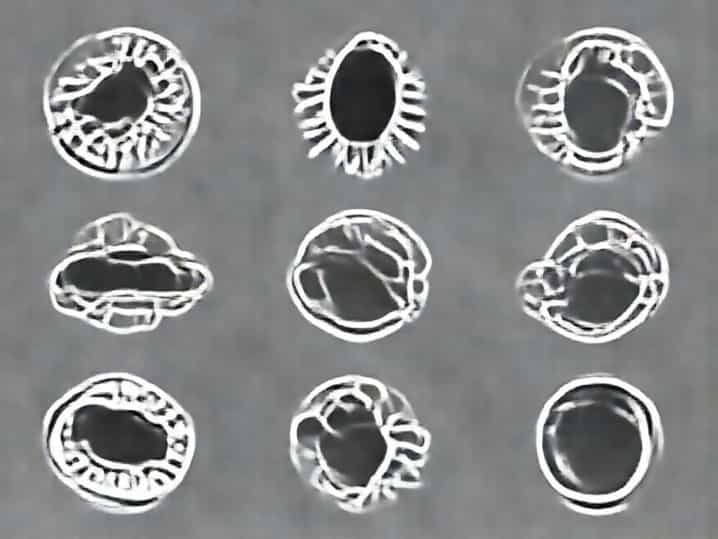 Reproduction In Protozoa Involves