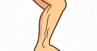 Unilateral Leg Edema Can Signify