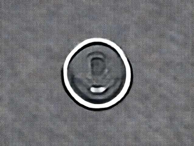 Zero Therapy Perioral Dermatitis