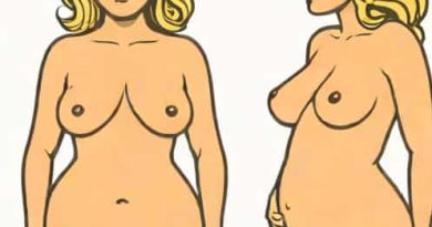 Goldilocks Mastectomy Before And After