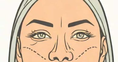 How Many Units Of Botox For Frown Lines
