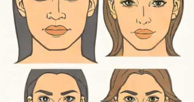 Puffy Hypothyroid Face Before And After
