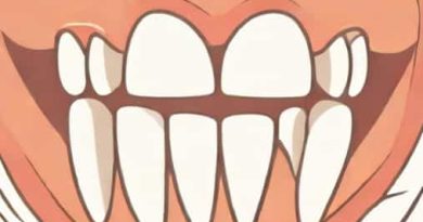 Back Of Teeth Feel Gritty